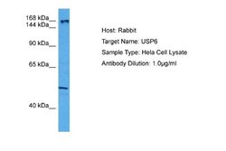 USP6 Antibody, Novus Biologicals 100 &mu;L; Unconjugated:Antibodies, Polyclonal